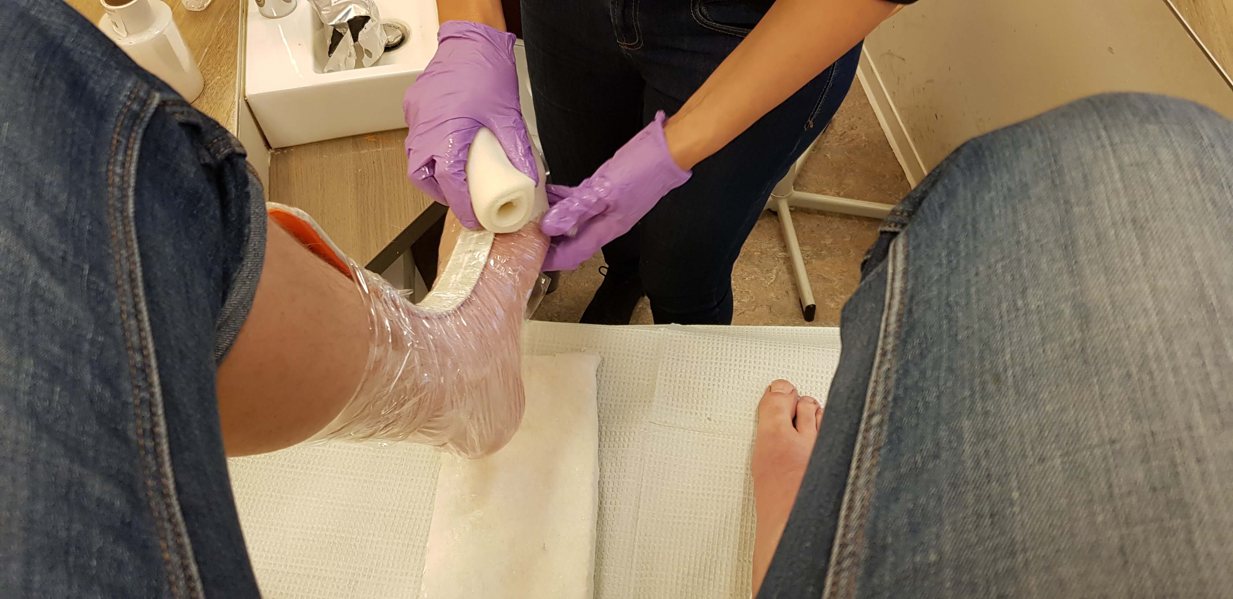 stap 3 inwikkelen van voet met gipsverband plaster voor het maken van gipsafdrukken voor leesten voor orthopedische schoenen