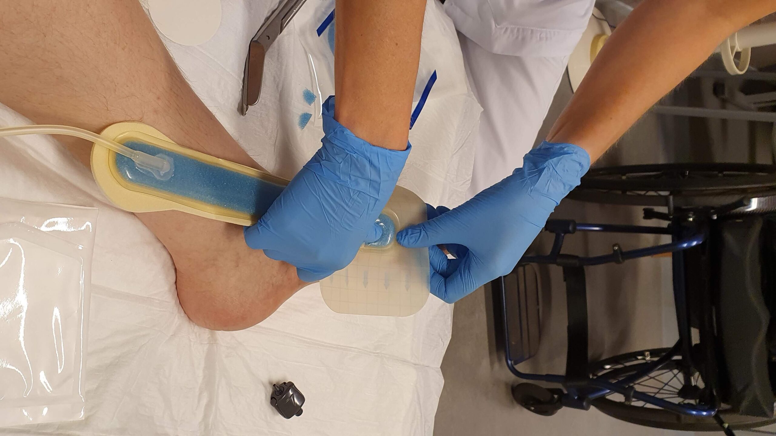 foto van voet die door een verpleegster, alias Florence Nightingale, wordt verzorgd met rechts in beeld de rolstoel van de patiënt.