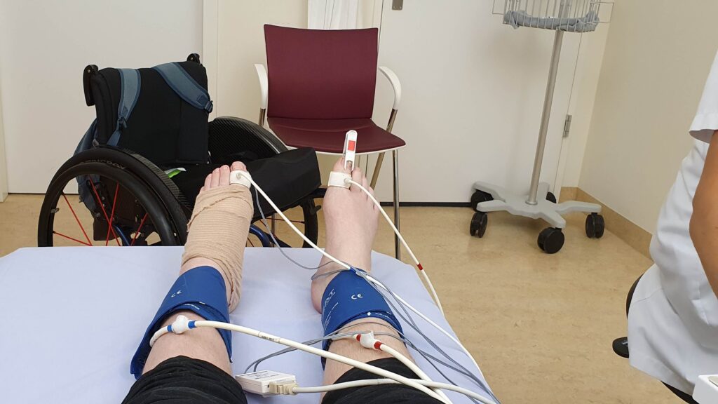 afbeelding van twee benen en voeten met allerlei medische draden en sensoren om de bloedsomloop te meten met op de achtergrond een rolstoel