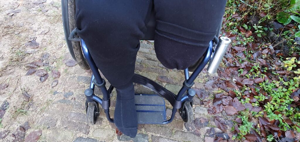 Afbeelding van een rolstoel met een compleet been en een geamputeerd ben, waarvan het stompje verborgen is in een omgevouwen trainingsbroek, behorend bij de blog over de ode aan mijn stomp na amputatie.