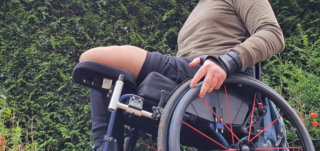 afbeelding van een man in een actieve rolstoel met daarop een stompsteun onder het geamputeerde linker onderbeen in een stompkous die hij kreeg bij de intake van de revalidatie