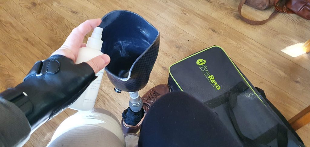 afbeelding van een prothese waarbij met alcoholspray de ring van de liner met vacuüm aan de stomp bevestigd wordt, terwijl je die spray als medische kosten zelf moet betalen.
