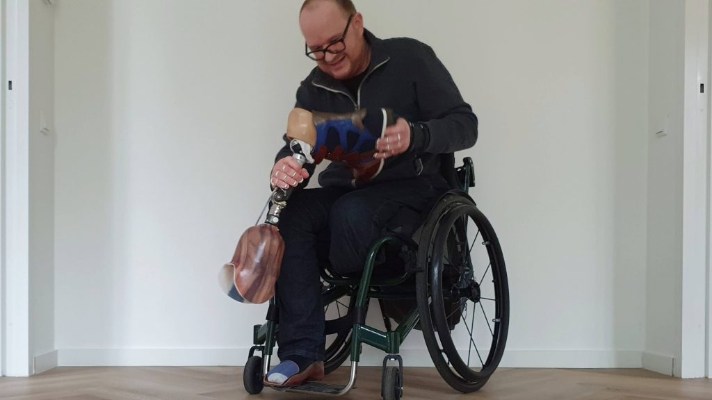 Man in groene rolstoel haalt de schoen van zijn onderbeenprothese af, die hij in zijn handen heeft.