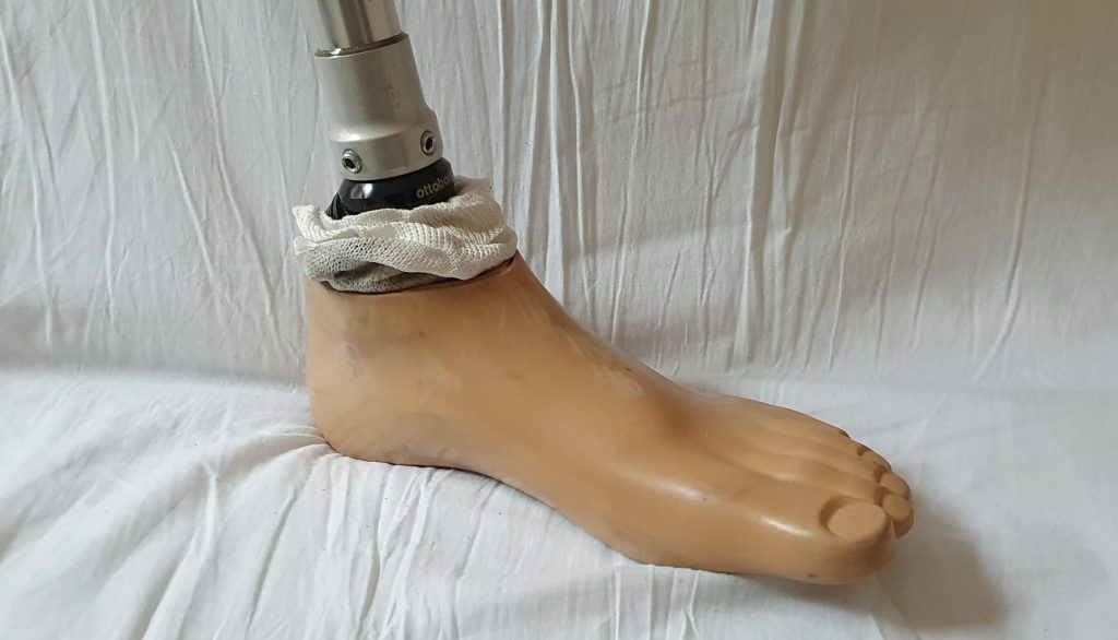 Foto van een deel van een linker been prothese waarvan je ziet dat er een tweedehands voet onder zit met vlekken, butsen en krassen. Je ziet ook nog net een stukje prothesebuis met een vieze beschermende witte sok. De tenen van de rubber prothesevoet zijn duidelijk nep.