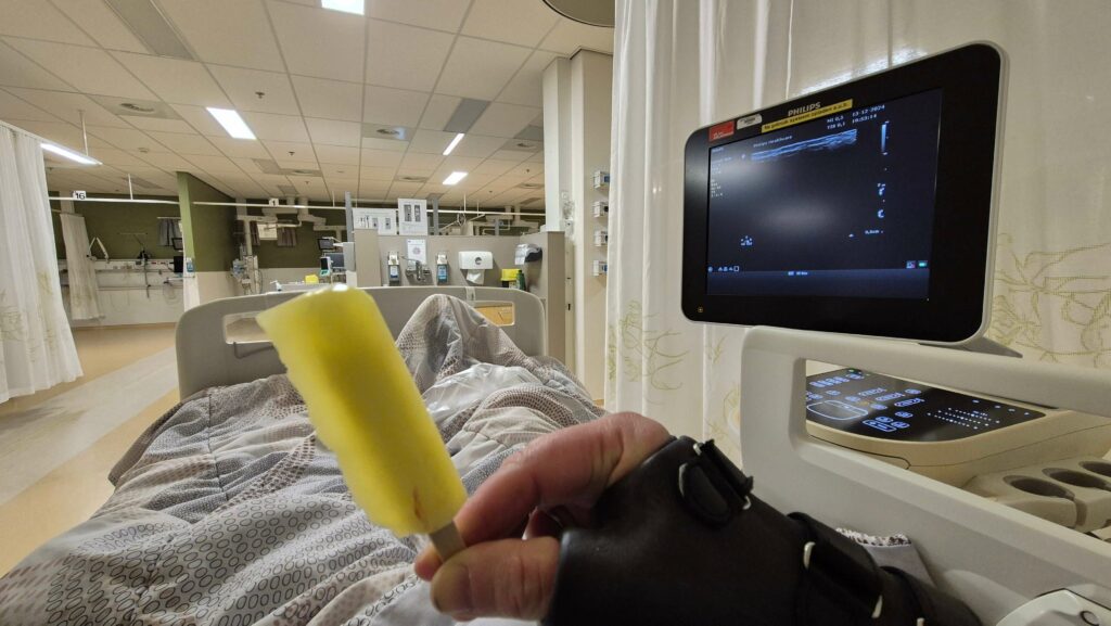 Afbeelding vanuit het perspectief van een patiënt op de verkoeverkamer na een operatie. Je ziet rechts een monitor en een hand in een polshandbrace houdt een waterijsje vast. op de achtergrond zie je nog lege ruimtes van de verkoeverkamer en de centrale post van de verpleegkundigen van de holding en de verkoeverkamer.