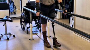 Foto van de benen van een man die aan het revalideren is na een bovenbeenamputatie. Hij draagt een korte broek, zodat zijn linker beenprothese goed zichtbaar is en aan zijn rechtervoet draagt hij een blauw met bruine orthopedische schoen. De prothese kreeg de naam Murphy.