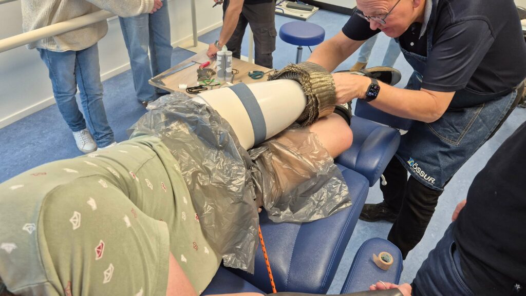 dr. Anton Johanesson van Össur geeft een clinic aan prothesemakers van ForMotion Orthopedie over het vervaardigen van een direct socket prothesekoker op de stomp van een man met een bovenbeenamputatie.