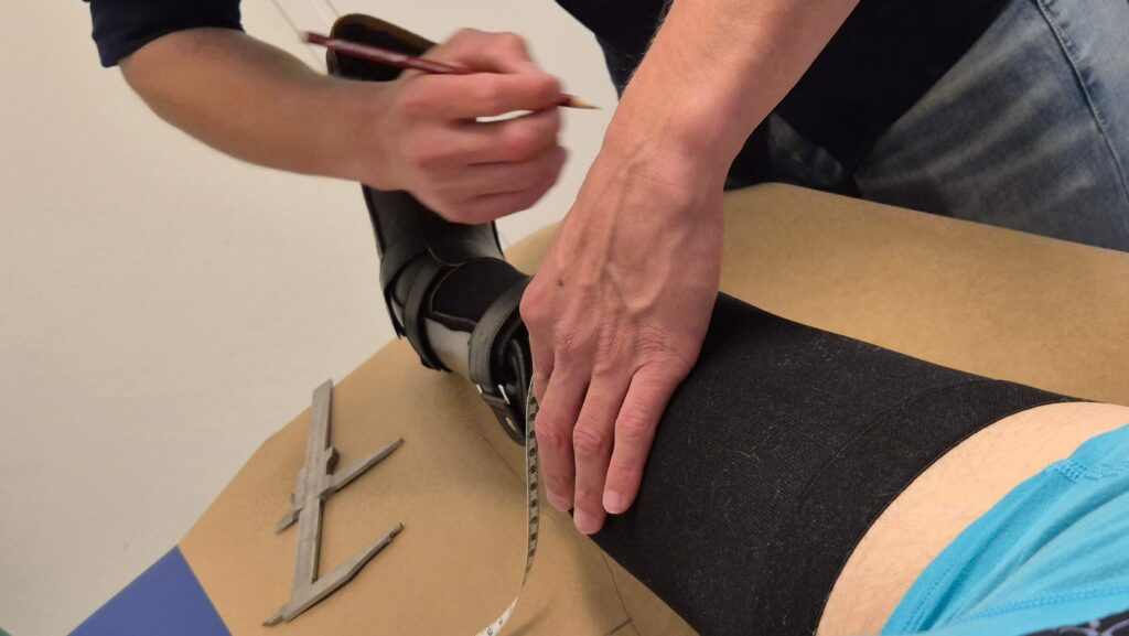 Afbeelding van een rechterbeen met een zwarte lange therapeutische steunkous (oftewel een Therapeutische Elastische Kous/TEK). Ook draagt deze persoon daar een zwarte enkelvoetorthese overheen. Je ziet ook de handen van de orthopedisch instrumentmaker die met een meetlint en een grote schuifmaat de maten van het been opmeet en daarna met potlood noteert op een groot vel bruin papier dat onder het been ligt. Ook heeft de orthesemaker de omtrek van het been daarop afgetekend.